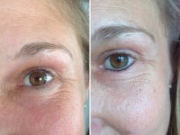 Permanent-Make-up vorher/nacher