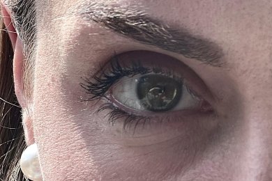 Frau schaut mit einem Auge in die Kamera bei Sonnenschein.